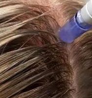 Needling bei Haarausfall, Scalp Kopfhaut Behandlung medical Behan Saarland - Großrosseln Vorschau