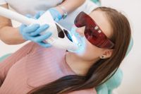 Kosmetische Zahnaufhellung Bleaching für Strahlend weiße Zähne Rheinland-Pfalz - Traben-Trarbach Vorschau