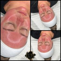 Gesichtsbehandlungen Peeling & Maske Fruchtsäurepeeling Nordrhein-Westfalen - Datteln Vorschau