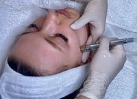 Diamant Microdermabrasion Gesichtsbehandlung Hessen - Kassel Vorschau