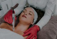 Microneedling Behandlung Bayern - Hepberg Vorschau