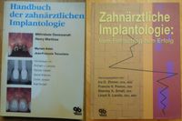 Handbuch der zahnärztlichen Implantologie  Vom Fehlschlag zum Frankfurt am Main - Nordend Vorschau