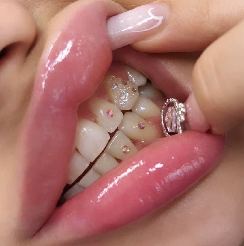 Gemme dentali corso online in München