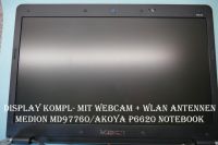 Notebook Display - MEDION MD97760/AKOYA P6620 Nordrhein-Westfalen - Bedburg-Hau Vorschau