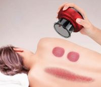 Schröpf Massage Therapie  Entschlacken  anti cellulite Bremen - Neustadt Vorschau