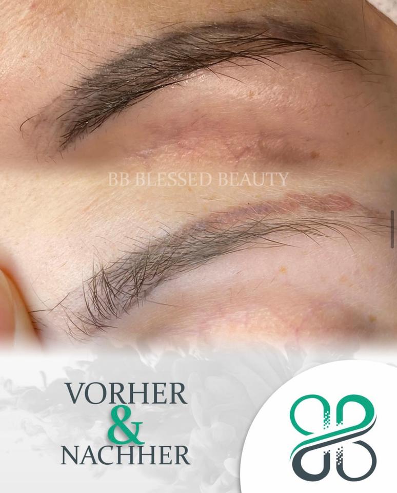 Mobile permanent make up Entfernung / Tattoo Entfernung / Remover in Centrum