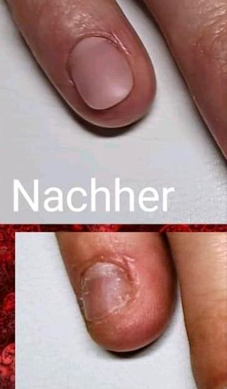 Nagelprothetik Nagelstudio Gelnägel Nagelmodellage in Oldenburg