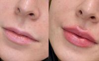 Permanent makeup Lippen Schulung Pmu Kurs Aquarell lips +Gerät Nordrhein-Westfalen - Hagen Vorschau