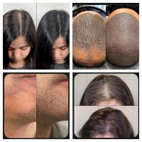 Scalp Haarpigmentierung Schulung Kopfhautpigmentierung Rheinland-Pfalz - Herdorf Vorschau