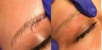 Microblading Permanent make up Entfernung mit dem Pigment Killer Burglesum - Burg-Grambke Vorschau