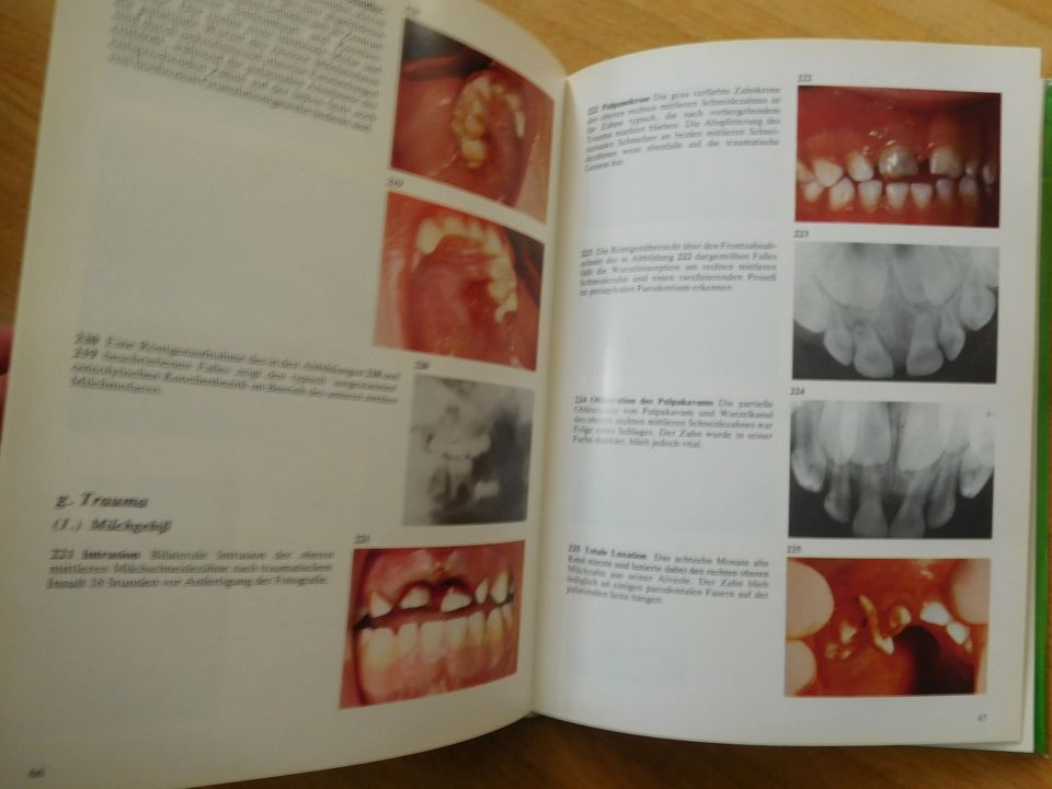 Praxis der Kinderzahnheilkunde Farbatlas Taschenatlas in Frankfurt am Main