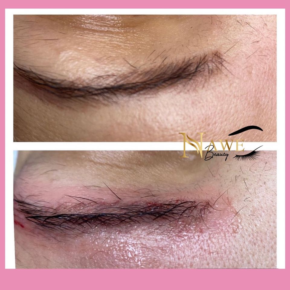 Entfernung Microblading Permanent Make up Aufhellung Remover in Gelsenkirchen