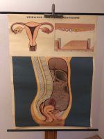Schulwandkarte Hagemann 1969 Weibliche Fortpflanzungsorgane Hessen - Lich Vorschau