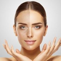 Microneedling Behandlung Nordrhein-Westfalen - Kalletal Vorschau