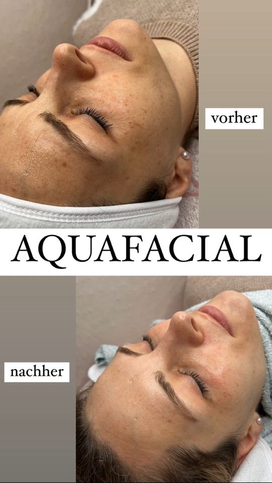 AQUA FACIAL Schulung NISV frei in Bad Eilsen