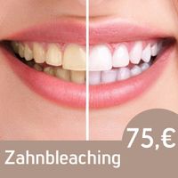 Zahnbleaching , Zahnaufhellung / Bleaching BKS Beauty Ibbenbüren Nordrhein-Westfalen - Ibbenbüren Vorschau