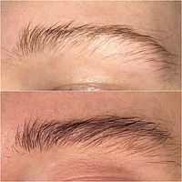 Vitamin Brows Microneedling BB Glow Schulung mobil möglich Niedersachsen - Oldenburg Vorschau