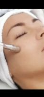 3in1 Diamant Microdermabrasion, Microneedling und Maske in Haren Niedersachsen - Haren (Ems) Vorschau