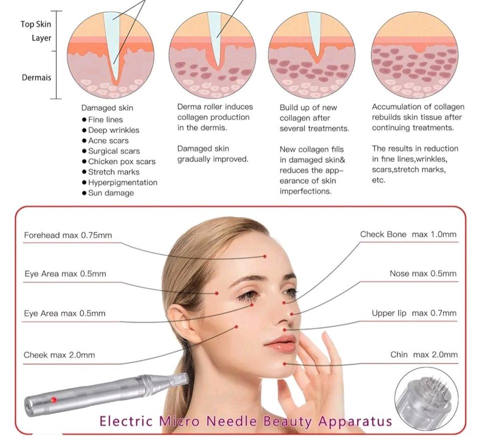BOWKA Elektrischer Derma Pen Microneedling Pen inkl. 12 Stück in Hofheim am Taunus