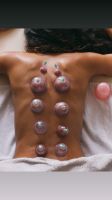 Hacamat/Schröpfen/Hijama Nordrhein-Westfalen - Gelsenkirchen Vorschau