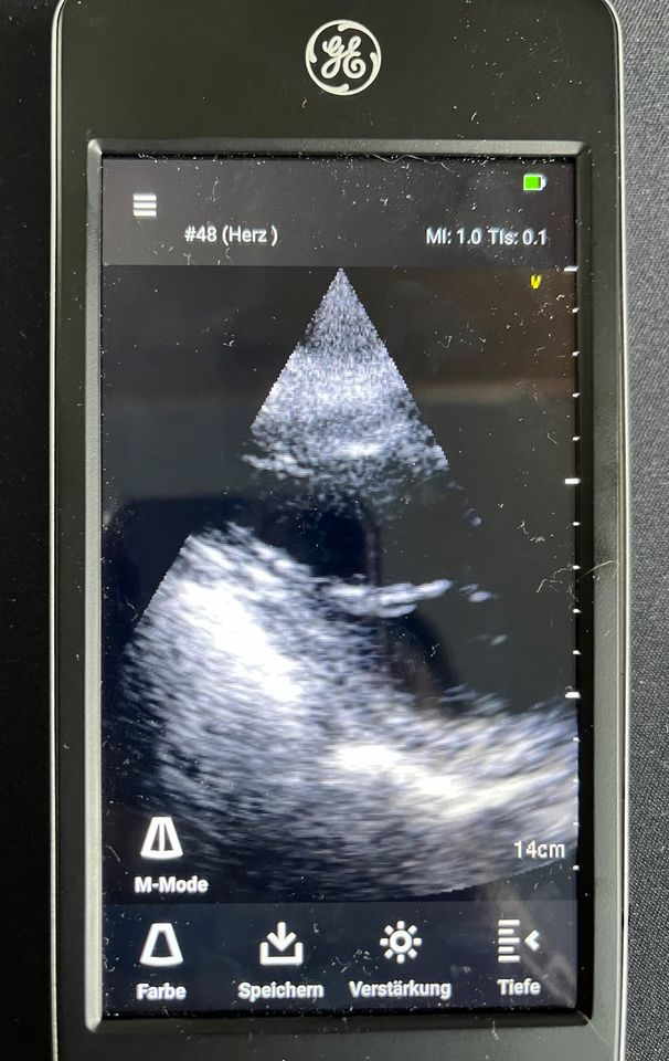 GE VScan Extend Dual Ultraschall Handheld POCUS Ultrasound in Bad Nenndorf