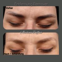 Entfernung Permanent Make-up Tattoo Remover Bergedorf - Hamburg Allermöhe  Vorschau