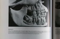 Die Entwicklung des menschlichen Gebisses - Atlas - Linden + Dute Berlin - Zehlendorf Vorschau