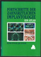Fortschritte der Zahnärztlichen Implantologie Ein Atlas Peter Te Baden-Württemberg - Waldachtal Vorschau