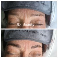 Brow Lifting Nordrhein-Westfalen - Kamen Vorschau