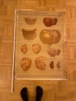 Altes antikes Anatomie Plakat lehrtafel Medizin Leber Alkohol München - Ludwigsvorstadt-Isarvorstadt Vorschau