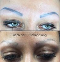 Entfernung von Permanent make up Münster (Westfalen) - Geist Vorschau