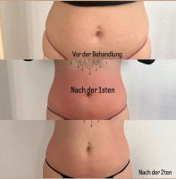 Angebot! Bodyshaper - deine Sommerfigur! Hannover - Linden-Limmer Vorschau