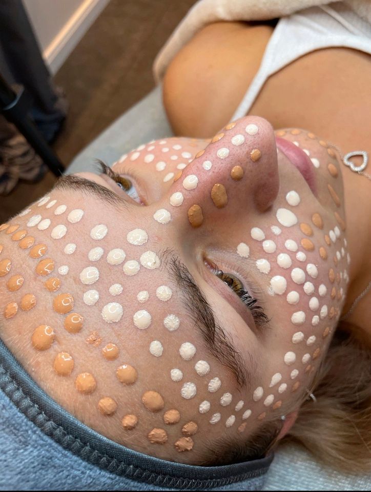 Microneedling , BB-Glow, Gesichtsbehandlung, Beauty in Melbeck in Lüneburg