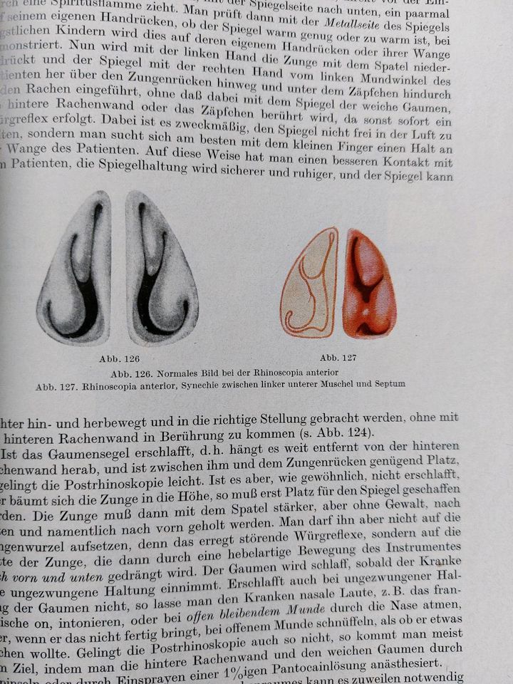 Lehrbuch der Hals, Nasen und Ohrenkrankheiten,Steurer in Centrum