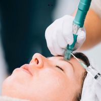 Microneedling Behandlung Nordrhein-Westfalen - Halle (Westfalen) Vorschau