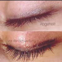 Permanent Make up Entfernung microblading tattoo Bayern - Kammeltal Vorschau