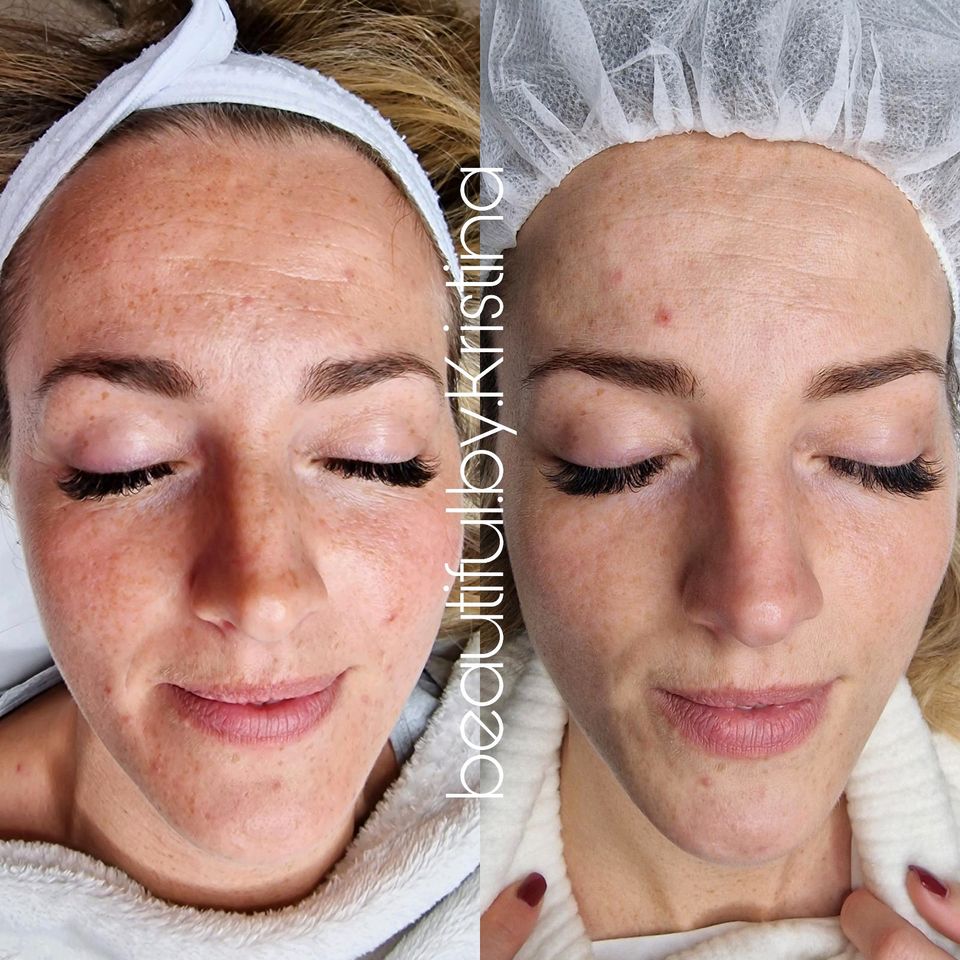 Kosmetik permanent Makeup tattoo Maniküre pediküre microneedling in Wadersloh