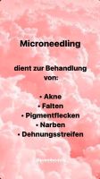 Microneedling Dortmund - Innenstadt-Ost Vorschau