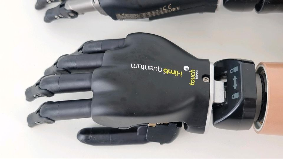 Handprothese Össur i-Limb Quantum beonics Prothetik in Paderborn