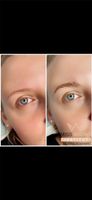 Browlifting Nordrhein-Westfalen - Hagen Vorschau