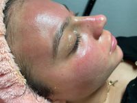 Aquafacial Microneedling BBGLOW  Schulung 300€ Rabatt Hamburg-Mitte - Hamburg Horn Vorschau