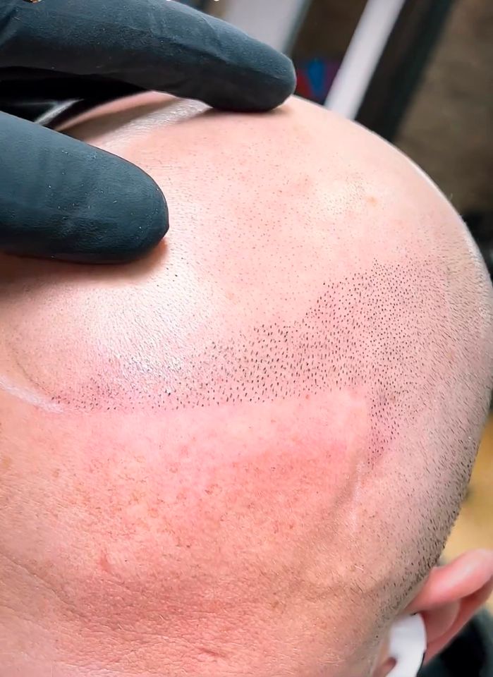 Haarpigmentierung Hair Tattoo in Rosenheim SMP Scalp Micro Pigmentation Haartätowierung Haar Pigmentierung Rosenheim in Rosenheim