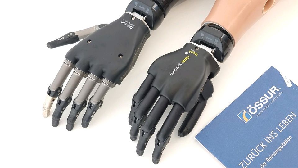 Handprothese Össur i-Limb Quantum beonics Prothetik in Paderborn