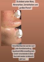 Microneedling- Gesichtsbehandlungen und Schulungen Niedersachsen - Bad Fallingbostel Vorschau