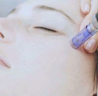 Bb glow Schulung, Microneedling Schulung, Needling Saarland - Großrosseln Vorschau