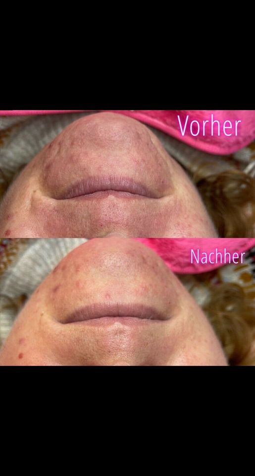 Nageldesign, Wimpernverlängerung, Microneedling Schulung in Grebenau