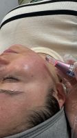 Modelle für Microneedling & Gesichtsreinigung Friedrichshain-Kreuzberg - Kreuzberg Vorschau