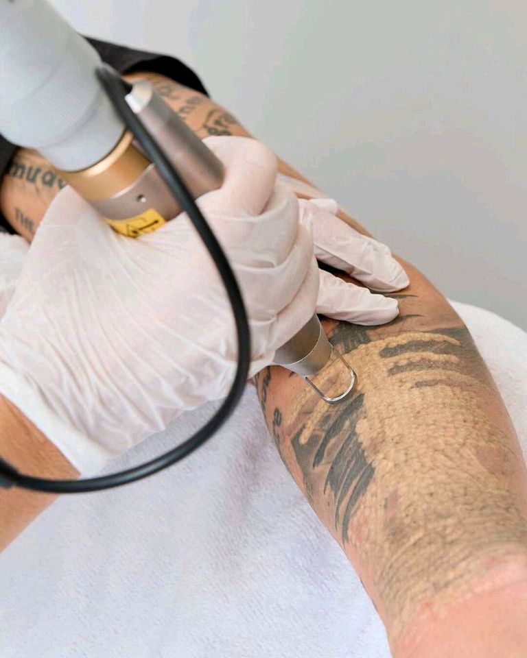 Botox, Hyaluronsäure, Tattooentfernung, Laser, PRP Behandlung in Ludwigsburg