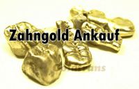 Zahngold ankauf Hamburg - Möchten Sie Ihr Zahngold verkaufen? Hamburg - Wandsbek Vorschau