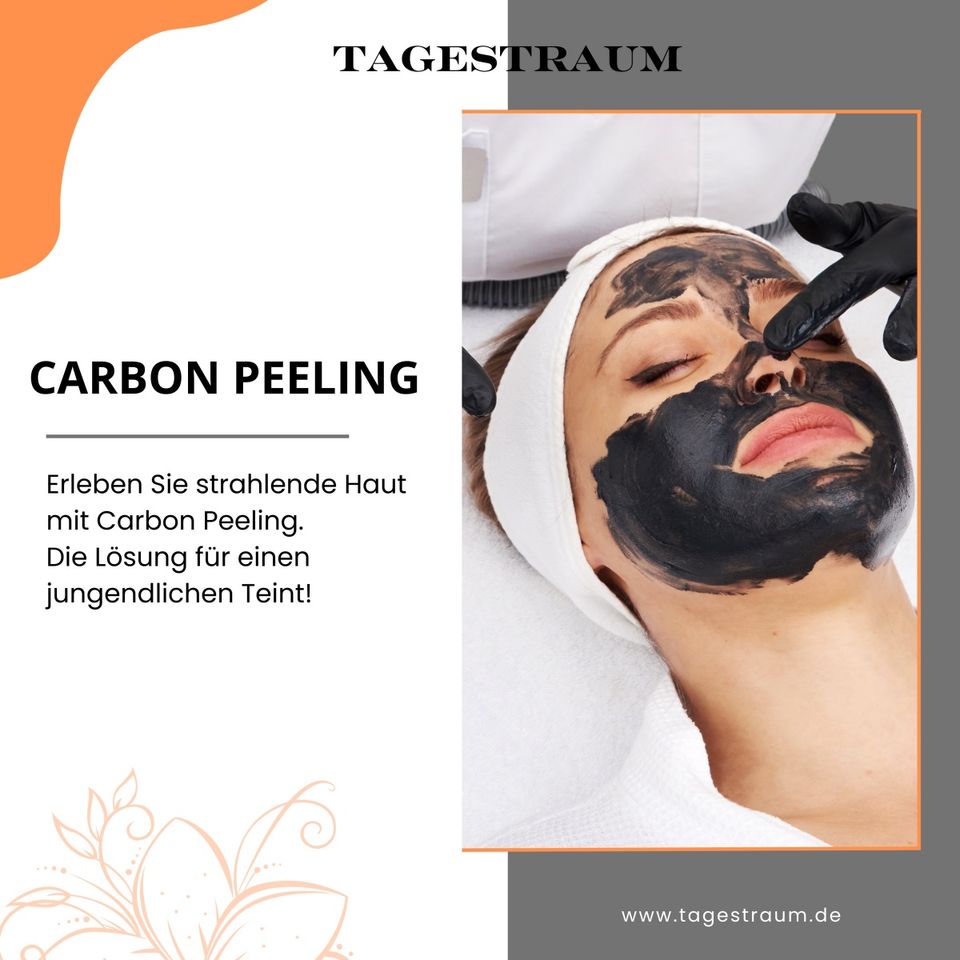 Laserpeeling gegen Akne, Pigmentierung und zur Porenverkleinerung in Hamburg